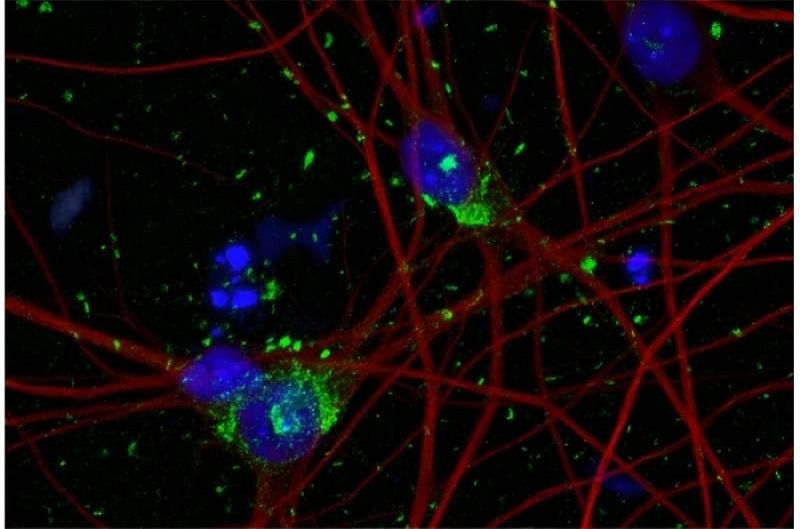 人类神经元研究新模型面世，有望带来阿尔茨海默病新疗法