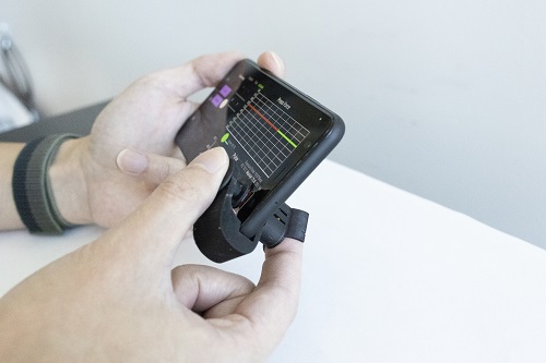 低成本手机配件测量血压“触手可及”