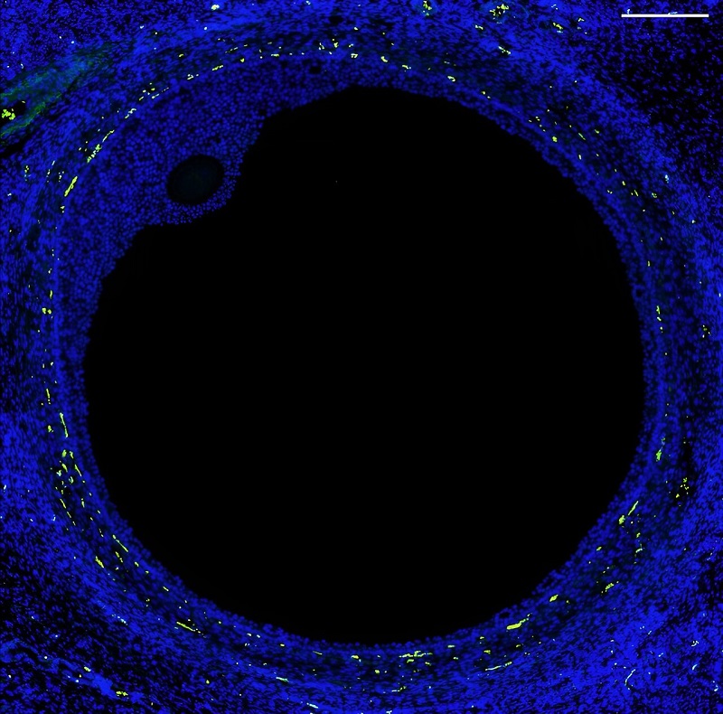 细胞级分辨率人类卵巢图谱发布